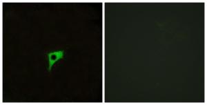 Immunofluorescence analysis of LOVO cells using Anti-CHRM2 Antibody. The right hand panel represents a negative control, where the antibody was pre-incubated with the immunising peptide.