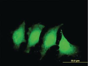 Anti-IL1B Mouse Monoclonal Antibody [clone: 2A8]