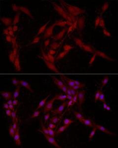 Immunofluorescence analysis of PC-12 cells using Anti-FABP5 Antibody (A11968) at a dilution of 1:200 (40X lens). DAPI was used to stain the cell nuclei (blue)