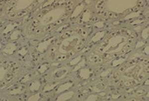 Immunohistochemistry analysis of mouse medullar kidney tissue