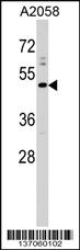 Anti-PRLHR Rabbit Polyclonal Antibody