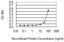 Anti-SASH1 Mouse Monoclonal Antibody [clone: 10B7]