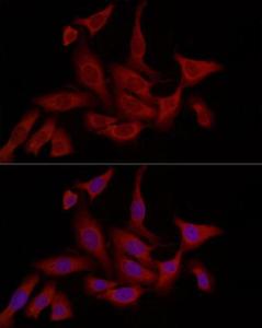 Immunofluorescence analysis of U2OS cells using Anti-FABP5 Antibody (A11968) at a dilution of 1:200 (40X lens). DAPI was used to stain the cell nuclei (blue)