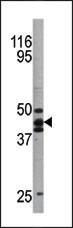 Anti-TP53 Rabbit Polyclonal Antibody (AP (Alkaline Phosphatase))