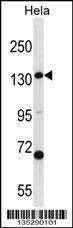 Anti-CPS1 Rabbit Polyclonal Antibody (AP (Alkaline Phosphatase))