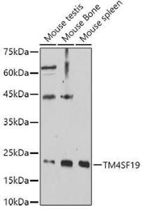 Western blot analysis of extracts of various cell lines, using Anti-TM4SF19 Antibody (A306632) at 1:1,000 dilution