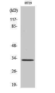 Western blot analysis of HuvEc cells using Anti-OR1S1 + OR1S2 Antibody