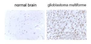 Anti-LC3B Rabbit Polyclonal Antibody (Biotin)