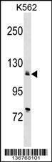 Anti-ATP2A2 Rabbit Polyclonal Antibody (Biotin)