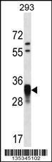 Anti-CCNO Rabbit Polyclonal Antibody (AP (Alkaline Phosphatase))