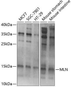 Western blot analysis of extracts of various cell lines, using Anti-Motilin Antibody (A11970) at 1:1,000 dilution