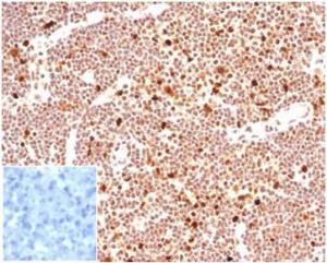 Immunohistochemical analysis of formalin-fixed, paraffin-embedded human lymph node tissue using Anti-PCNA Antibody [PCNA/6580]. Inset: PBS instead of the primary Antibody. Secondary Antibody negative control