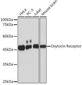 Western blot analysis of extracts of various cell lines, using Anti-Oxytocin Receptor Antibody [ARC2266] (A306634) at 1:1,000 dilution. The secondary antibody was Goat Anti-Rabbit IgG H&L Antibody (HRP) at 1:10,000 dilution.