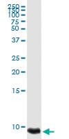 Anti-PF4 Rabbit Polyclonal Antibody