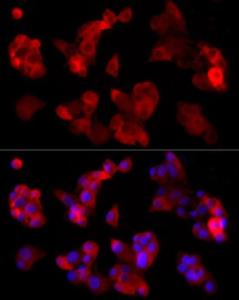 Immunofluorescence analysis of HepG2 using Anti-ABCA1 Antibody [ARC54239] (A305579) at a dilution of 1:200ã€1:1000 (40X lens). DAPI was used to stain the cell nuclei (blue)