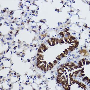 Immunohistochemistry analysis of paraffin-embedded mouse lung using Anti-MGST1 Antibody [ARC2550] (A307955) at a dilution of 1:100 (40x lens). Perform high pressure antigen retrieval with 10 mM citrate buffer pH 6.0 before commencing with IHC staining protocol