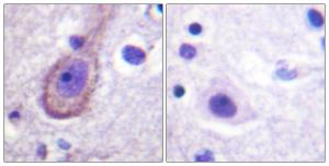 Immunohistochemical analysis of paraffin-embedded human brain using Anti-KCNQ3 (phospho Thr246) Antibody The right hand panel represents a negative control, where the antibody was pre-incubated with the immunising peptide