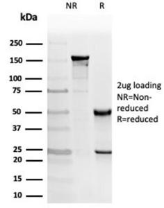 SDS-PAGE analysis of Anti-PKC iota Antibody [PRKCI/4912] under non-reduced and reduced conditions; showing intact IgG and intact heavy and light chains, respectively. SDS-PAGE analysis confirms the integrity and purity of the antibody