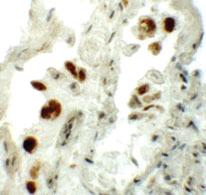 Anti-NUMB Rabbit Polyclonal Antibody