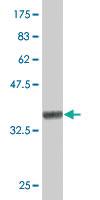 Anti-JPH1 Mouse Polyclonal Antibody