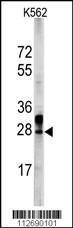 Anti-ERAS Rabbit Polyclonal Antibody (AP (Alkaline Phosphatase))