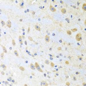 Immunohistochemistry analysis of paraffin-embedded mouse brain using Anti-Motilin Antibody (A11970) at a dilution of 1:100 (40X lens). Perform microwave antigen retrieval with 10 mM PBS buffer pH 7.2 before commencing with IHC staining protocol