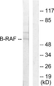 Western blot analysis of lysates from HeLa cells using Anti-B-RAF Antibody. The right hand lane represents a negative control, where the antibody is blocked by the immunising peptide