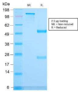 SDS-PAGE analysis of Anti-CD3 epsilon Antibody [C3e/3171R] under non-reduced and reduced conditions; showing intact IgG and intact heavy and light chains, respectively SDS-PAGE analysis confirms the integrity and purity of the antibody