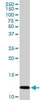 Anti-PF4 Rabbit Polyclonal Antibody