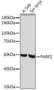 Western blot analysis of extracts of various cell lines, using Anti-PARP2 Antibody [ARC2099] (A306636) at 1:1,000 dilution. The secondary antibody was Goat Anti-Rabbit IgG H&L Antibody (HRP) at 1:10,000 dilution.