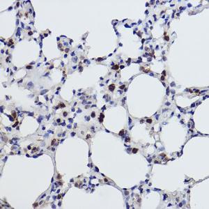 Immunohistochemistry analysis of paraffin-embedded rat lung using Anti-MGST1 Antibody [ARC2550] (A307955) at a dilution of 1:100 (40x lens). Perform high pressure antigen retrieval with 10 mM citrate buffer pH 6.0 before commencing with IHC staining protocol