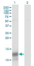 Anti-PF4 Mouse Monoclonal Antibody [clone: 3F6]