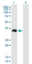 Anti-CENPV Mouse Polyclonal Antibody