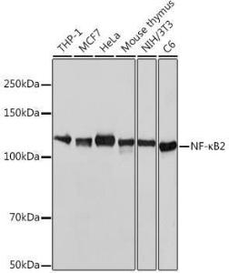 Western blot analysis of extracts of various cell lines, using Anti-NFkB p100/NFKB2 Antibody [ARC0084] (A306637) at 1:1,000 dilution The secondary antibody was Goat Anti-Rabbit IgG H&L Antibody (HRP) at 1:10,000 dilution Lysates/proteins were present at 25 µg per lane