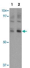 Anti-NUMB Rabbit Polyclonal Antibody