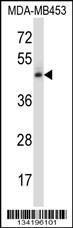 Anti-NR2F1 Rabbit Polyclonal Antibody (HRP (Horseradish Peroxidase))