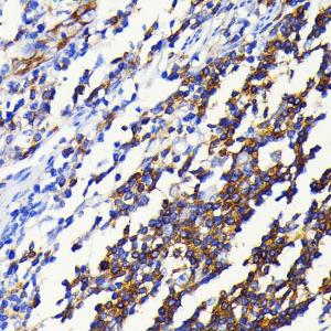 Immunohistochemistry analysis of paraffin-embedded human appendix tissue using Anti-NFkB p100/NFKB2 Antibody [ARC0084] (A306637) at a dilution of 1:100 (40x lens) Perform microwave antigen retrieval with 10 mM PBS buffer pH 72 before commencing with IHC staining protocol