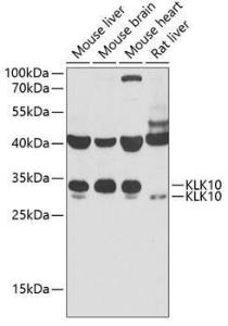 Western blot analysis of extracts of various cell lines, using Anti-Kallikrein 10/K10 Antibody (A11971) at 1:1,000 dilution