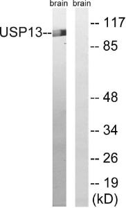 Western blot analysis of lysates from mouse brain using Anti-USP13 Antibody. The right hand lane represents a negative control, where the antibody is blocked by the immunising peptide.