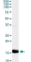 Anti-PF4 Mouse Monoclonal Antibody [clone: 3F6]