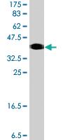 Anti-URI1 Mouse Polyclonal Antibody