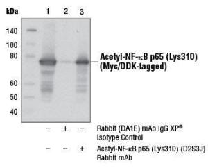 Anti-NFkB p65, acetaldehyde Rabbit Monoclonal Antibody [clone: 13G54]