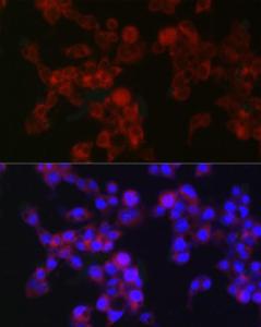 Immunofluorescence analysis of HepG2 cells using Anti-MGST1 Antibody [ARC2550] (A307955) at a dilution of 1:100 (40x lens). DAPI was used to stain the cell nuclei (blue)