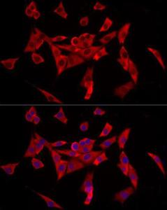 Immunofluorescence analysis of NIH/3T3 using Anti-ABCA1 Antibody [ARC54239] (A305579) at a dilution of 1:200ã€1:1000 (40X lens). DAPI was used to stain the cell nuclei (blue)