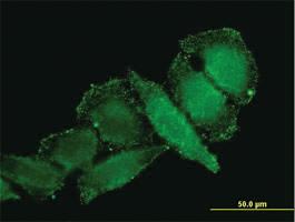 Anti-IL1B Mouse Monoclonal Antibody [clone: 2E8]