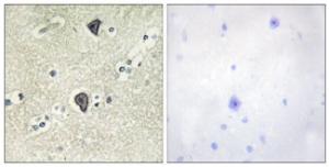 Antibody anti-FGFR3 100 µg