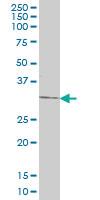 Anti-DKK1 Mouse Monoclonal Antibody [clone: 1F5]