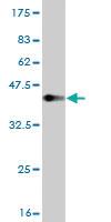 Anti-KYNU Mouse Monoclonal Antibody [clone: 1G2]