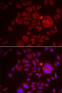 Antibody anti-SPINT1 100 µl