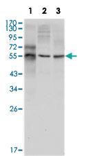 Anti-TUBB3 Mouse Monoclonal Antibody [clone: 2E9]